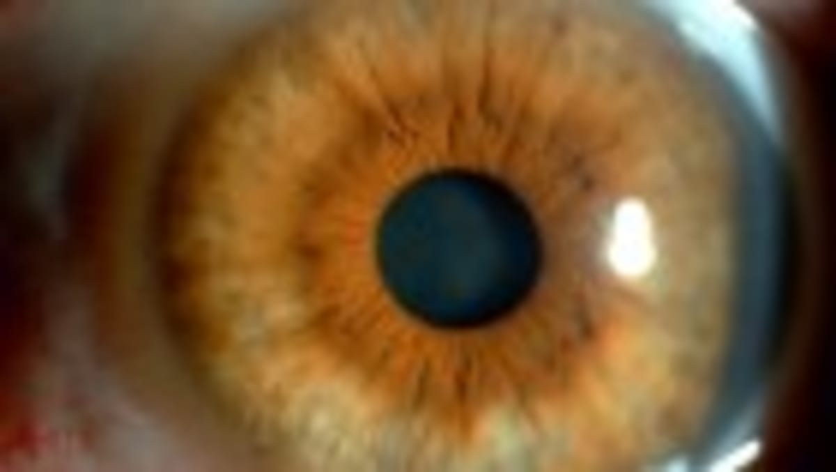 5 Psychedelics Show Similar Brain Patterns in 500+ Scans - Image 3