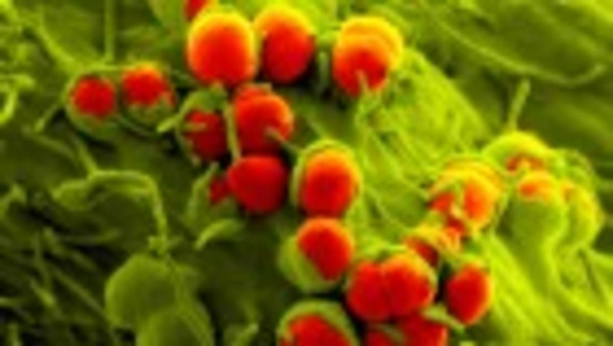Old Antibiotics Get New Life Fighting Superbugs - Image 5