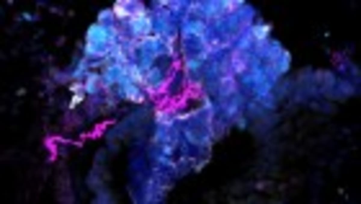 Scientists Find Ways to Cut Dementia Risk by 45% - Image 3