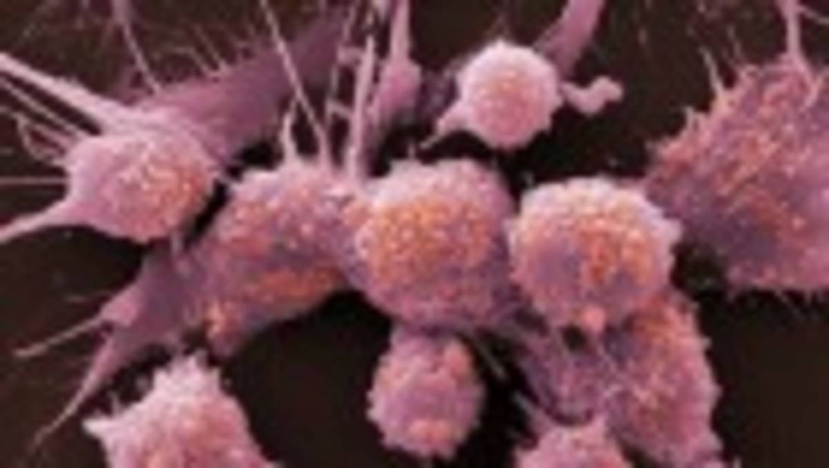 DNA Vaccine Shows Promise for Deadly Brain Cancer - Image 2