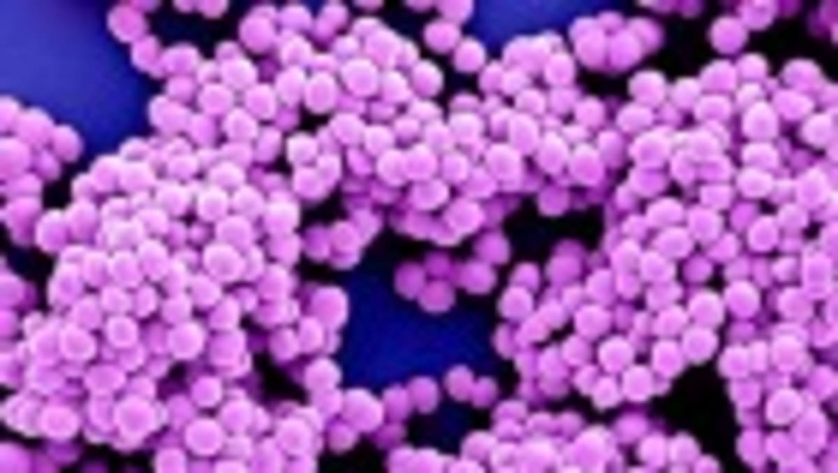 AI Discovers New Antibiotics for Drug-Resistant Gonorrhea - Image 4