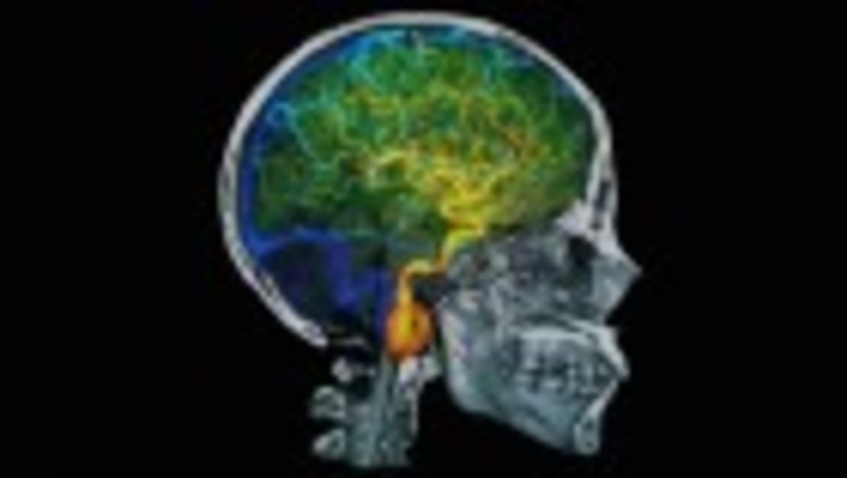 Scientists Map 1,000+ Brain Proteins Linked to Alzheimer's - Image 4