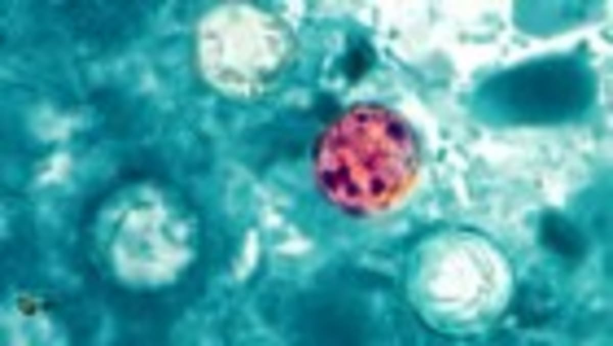 Scientists Discover How Common Virus Triggers MS - Image 2
