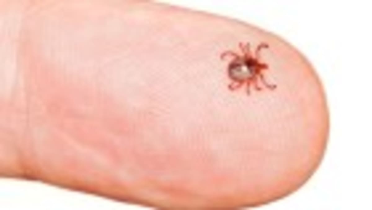Ancient DNA Solves 400-Year Smallpox Mystery in Chile - Image 5