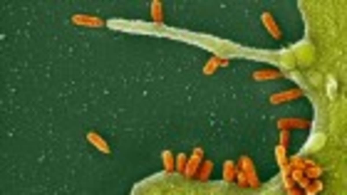 First Narcolepsy Drug Treats Root Cause, Not Just Symptoms - Image 2