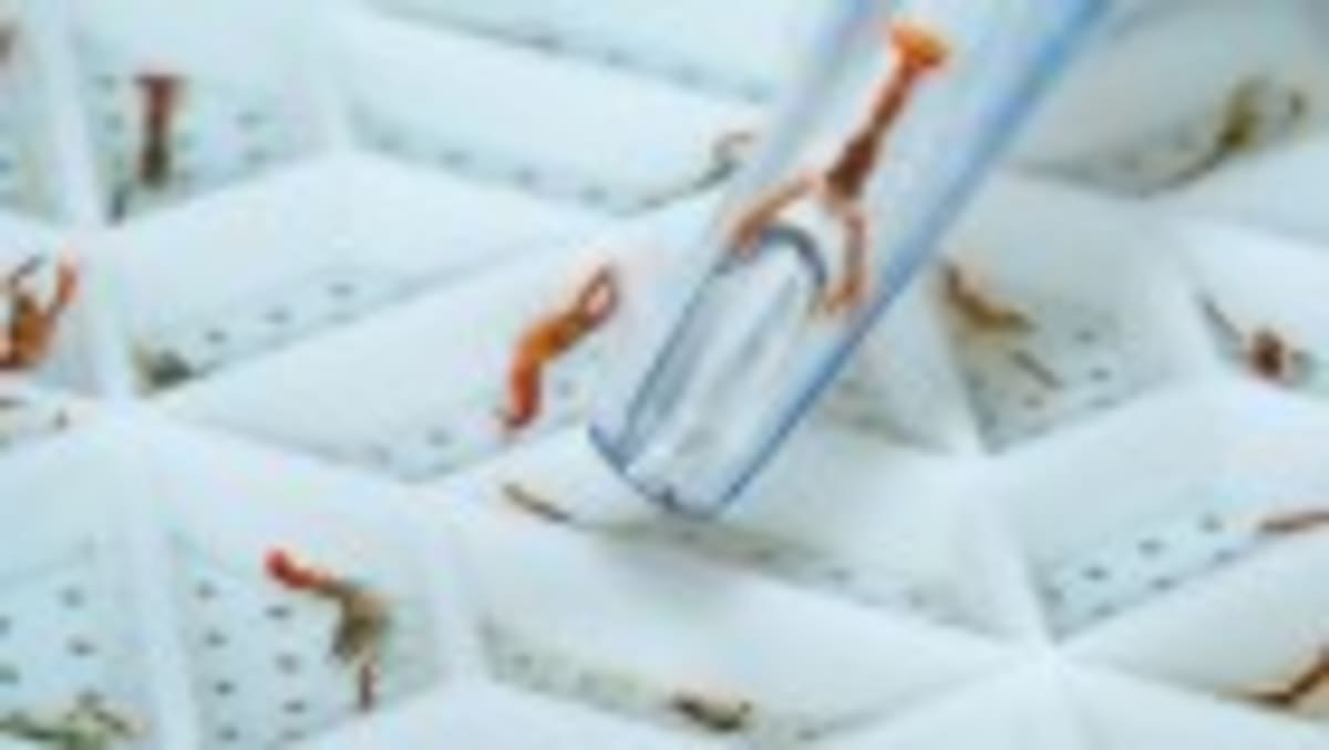 Scientists Buried 1,000 Underpants to Measure Soil Health - Image 3