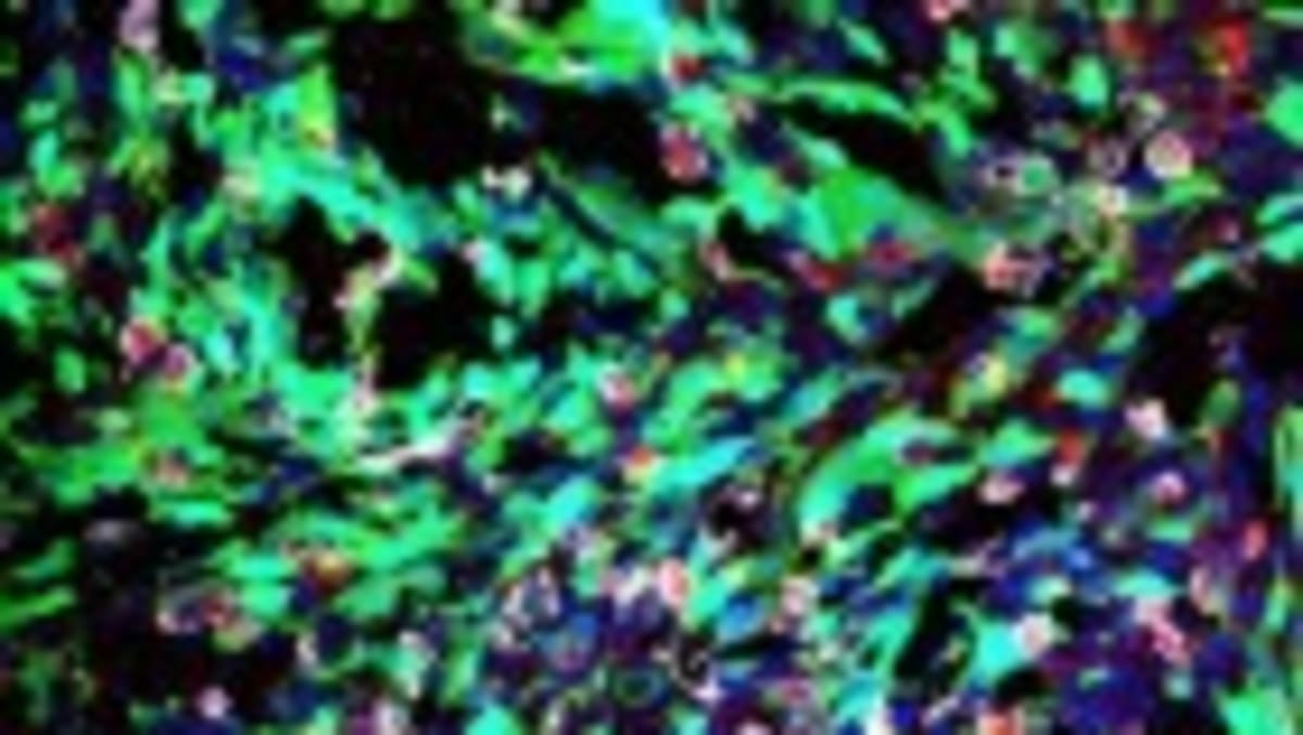 New Hepatitis B Treatment Silences Virus in Early Trials - Image 3