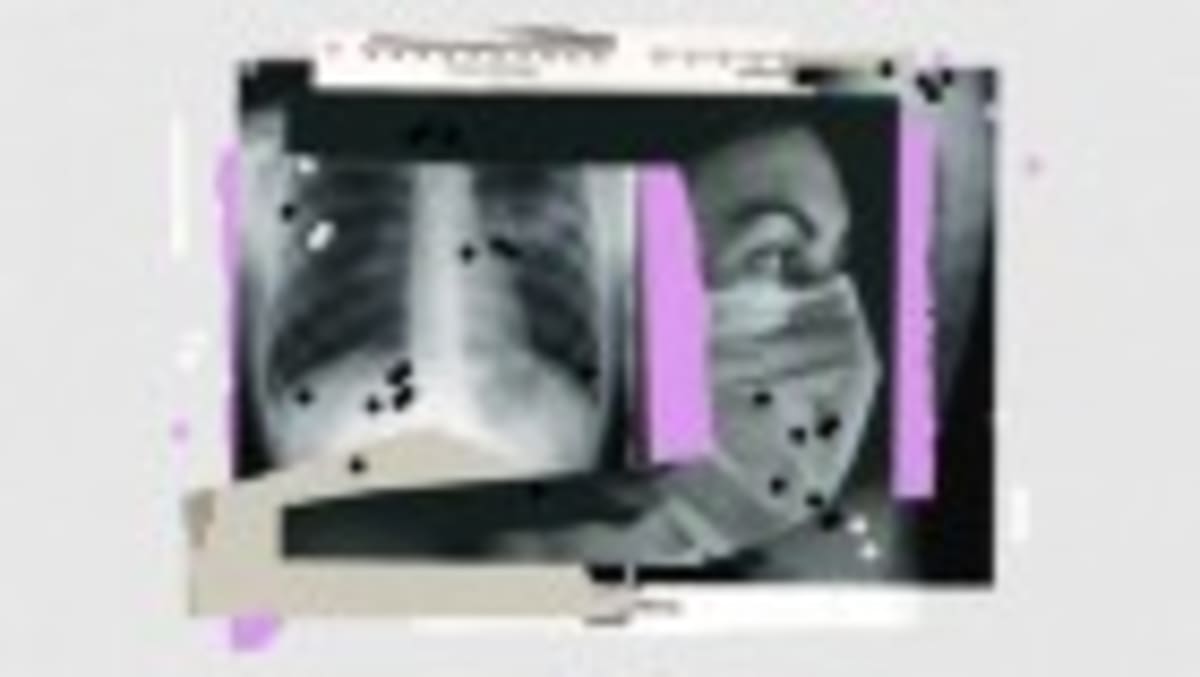 New MS Treatment Creates Healing Cells Inside the Body - Image 2