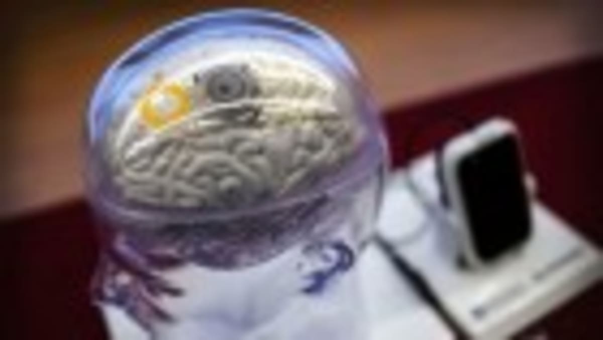 Gut Immune Cells Travel to Brain, Remember Infections - Image 5