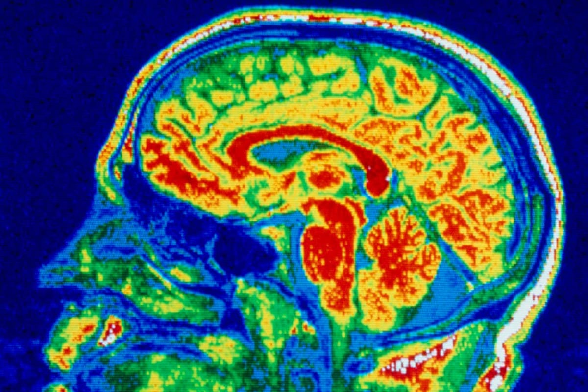 Keto Diet Shows Promise for Treating Anorexia - Image 3