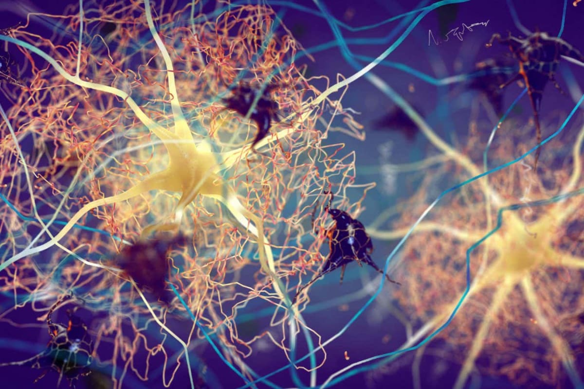 New Drug Combo May Delay Alzheimer's by 7 Years - Image 4