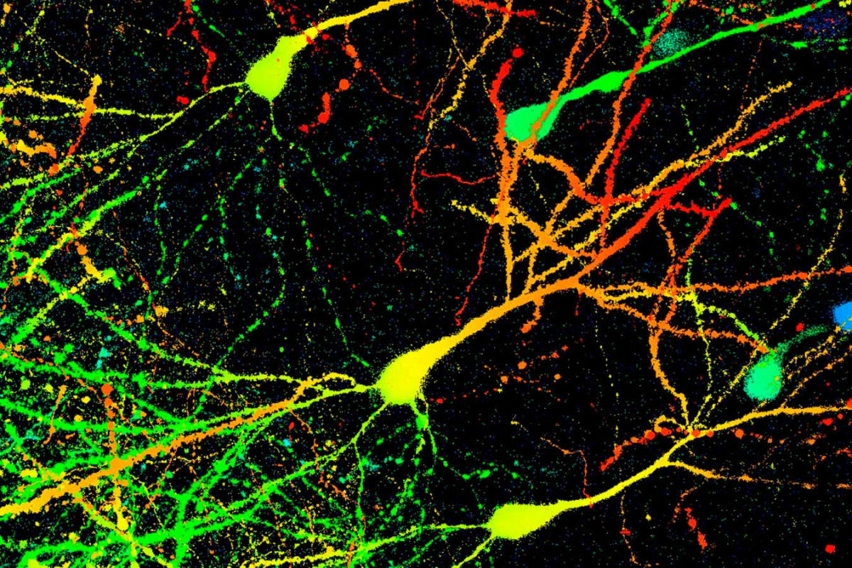 Fluorescent microscope image showing healthy mouse brain neurons glowing in different colors