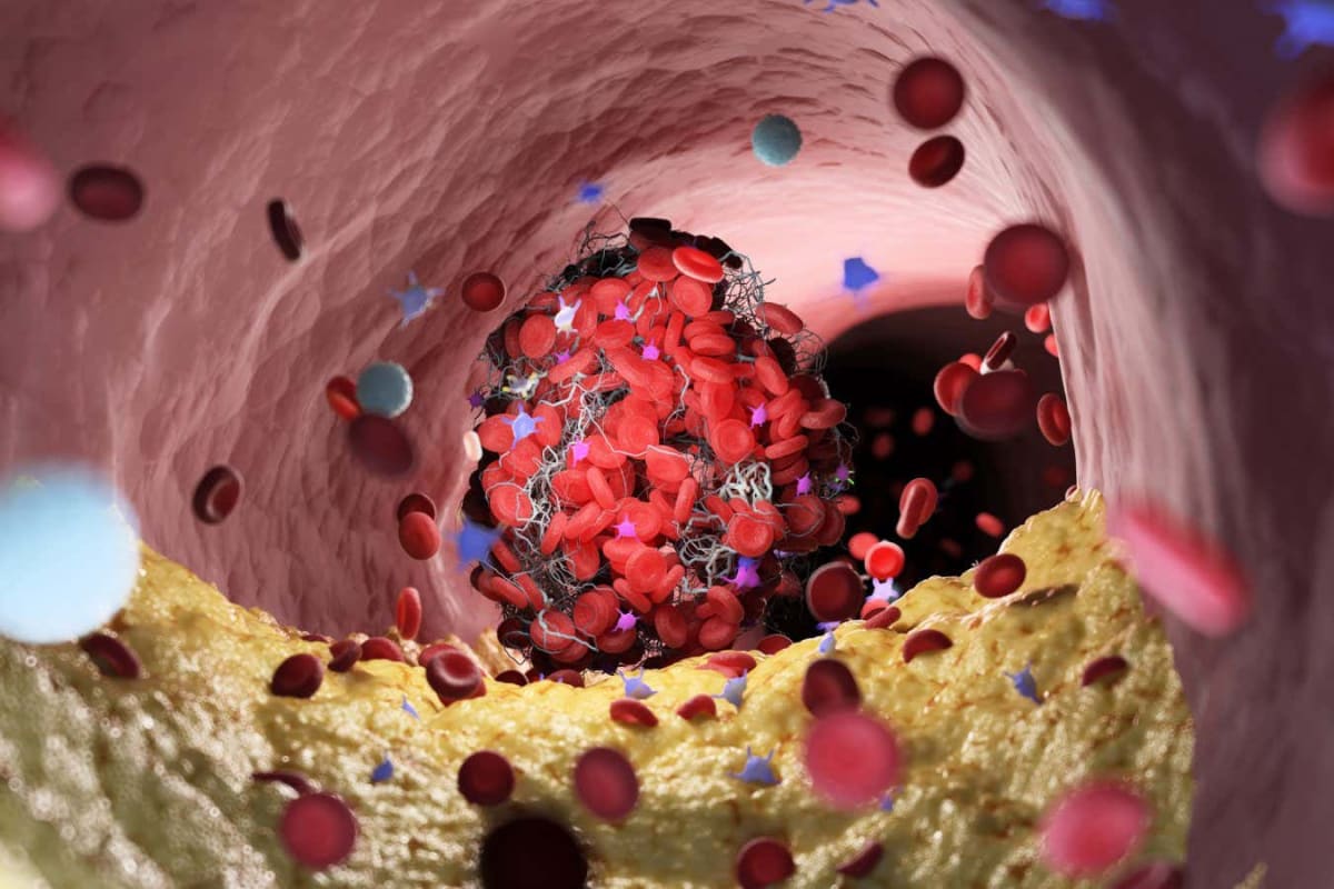 Blood Cell Breakthrough Stops Bleeding in 5 Seconds