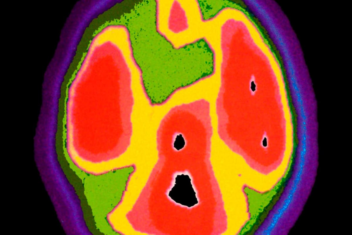 Autism Pioneer Uta Frith Rethinks the Spectrum After 60 Years - Image 4