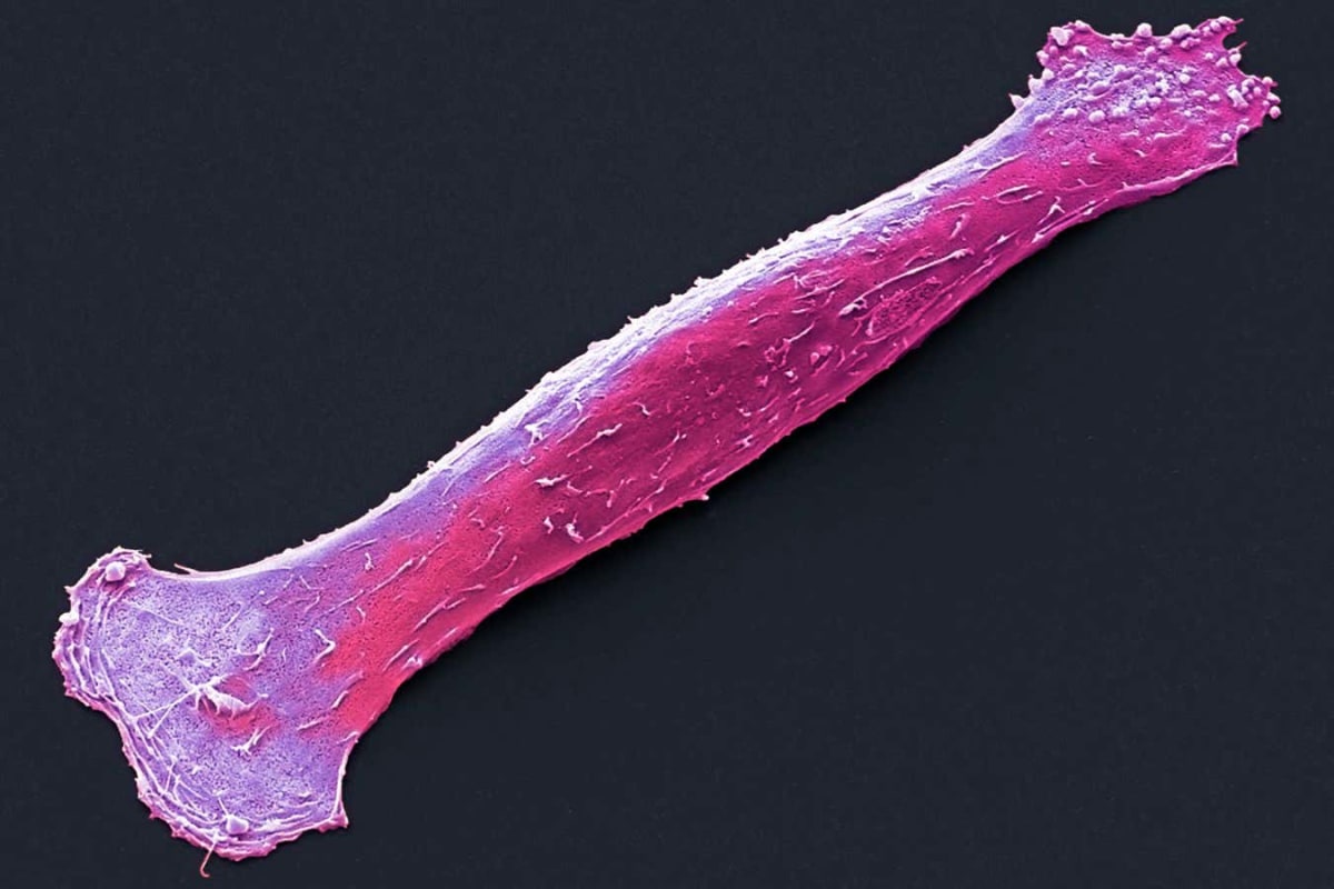Scientists Reboot Old Muscle Cells to Restore Youth in Mice