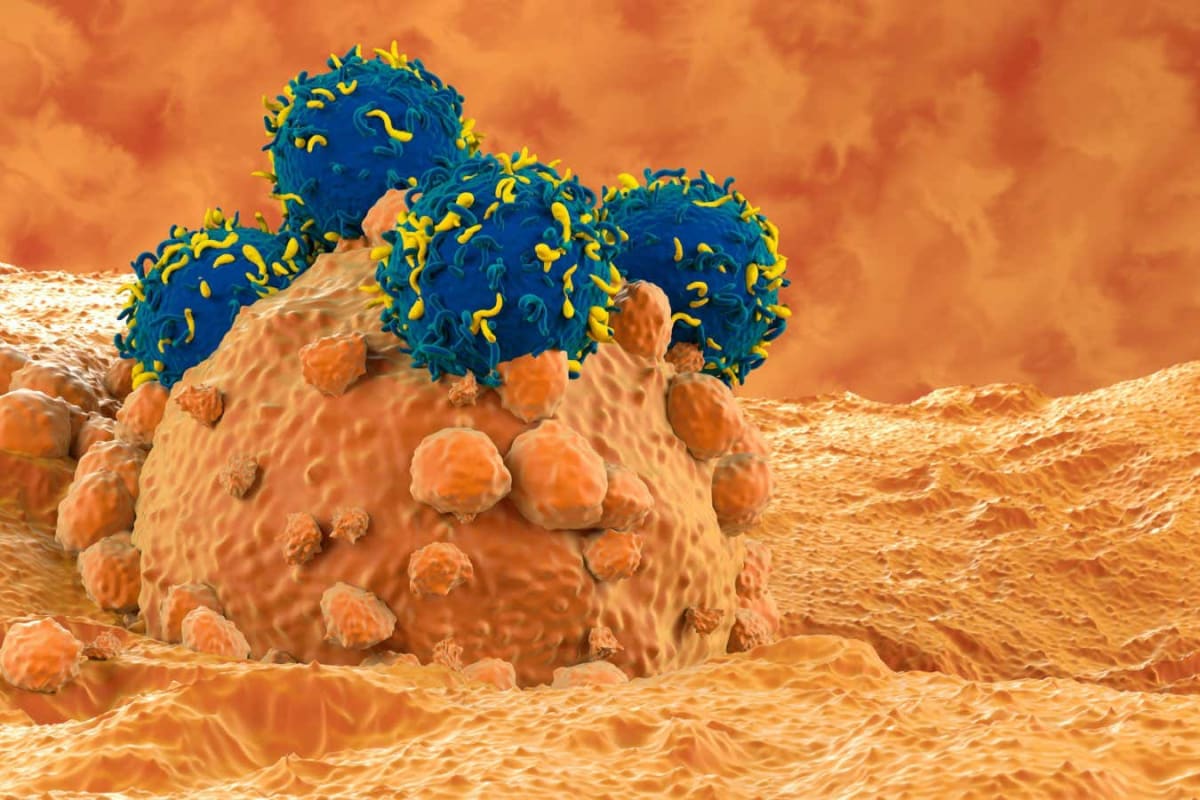 Medical illustration showing CAR T-cells attacking melanoma cancer cells in the human body