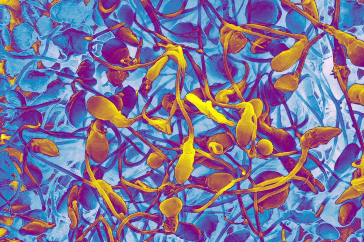Colorful microscopic image showing human sperm cells in scientific detail