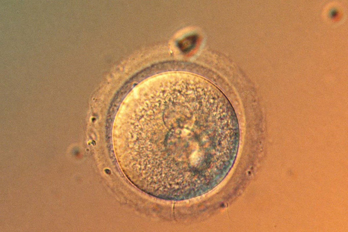 Scientists Target Screwworm for First Gene Drive Extinction - Image 2