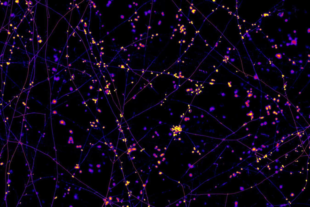 Scientists Map Earth's Hidden Fungal Networks for First Time - Image 3
