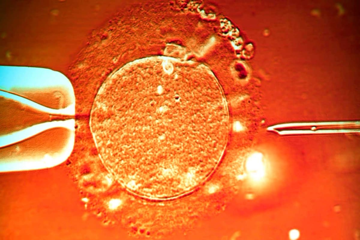 Lab-Grown Eggs Lead to Healthy Lambs in Fertility Win - Image 3