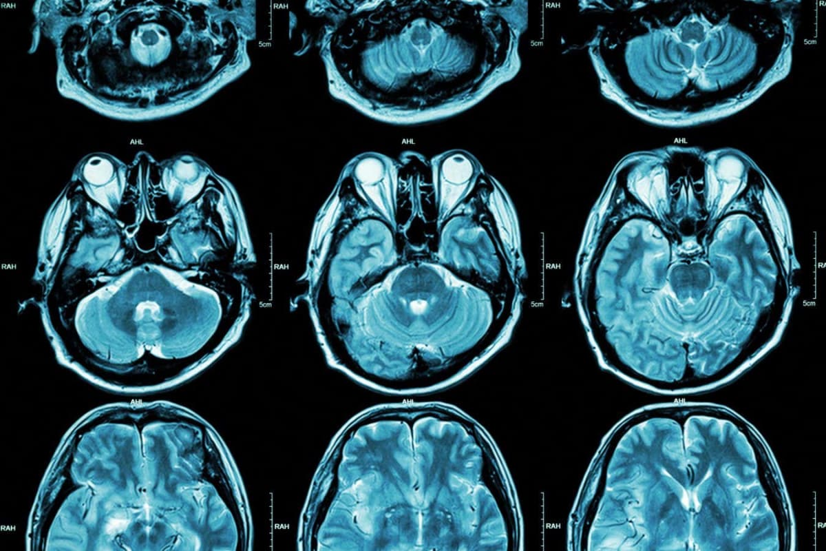 Gut Transplant Makes Old Mouse Brains Act Young Again - Image 5