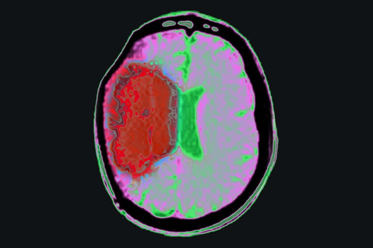 Gut Transplant Makes Old Mouse Brains Act Young Again - Image 3