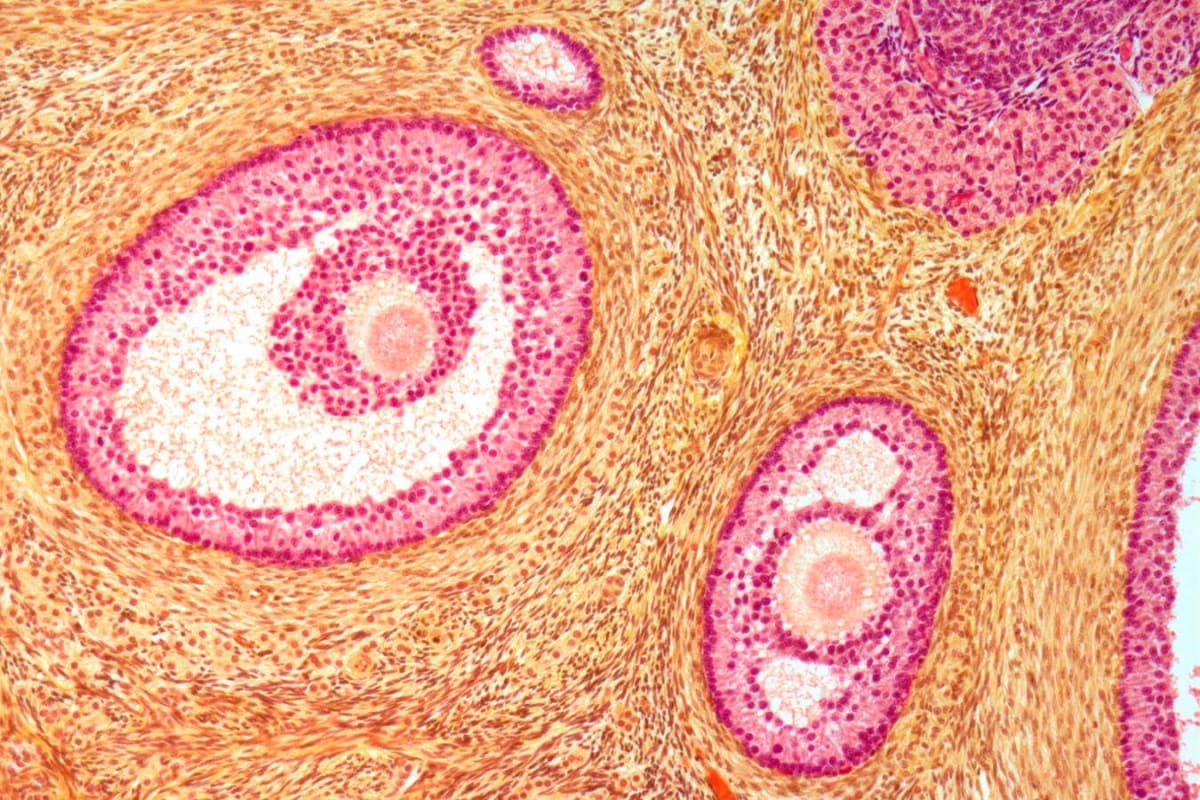 Softer Ovaries Double Fertility in Aging Rats