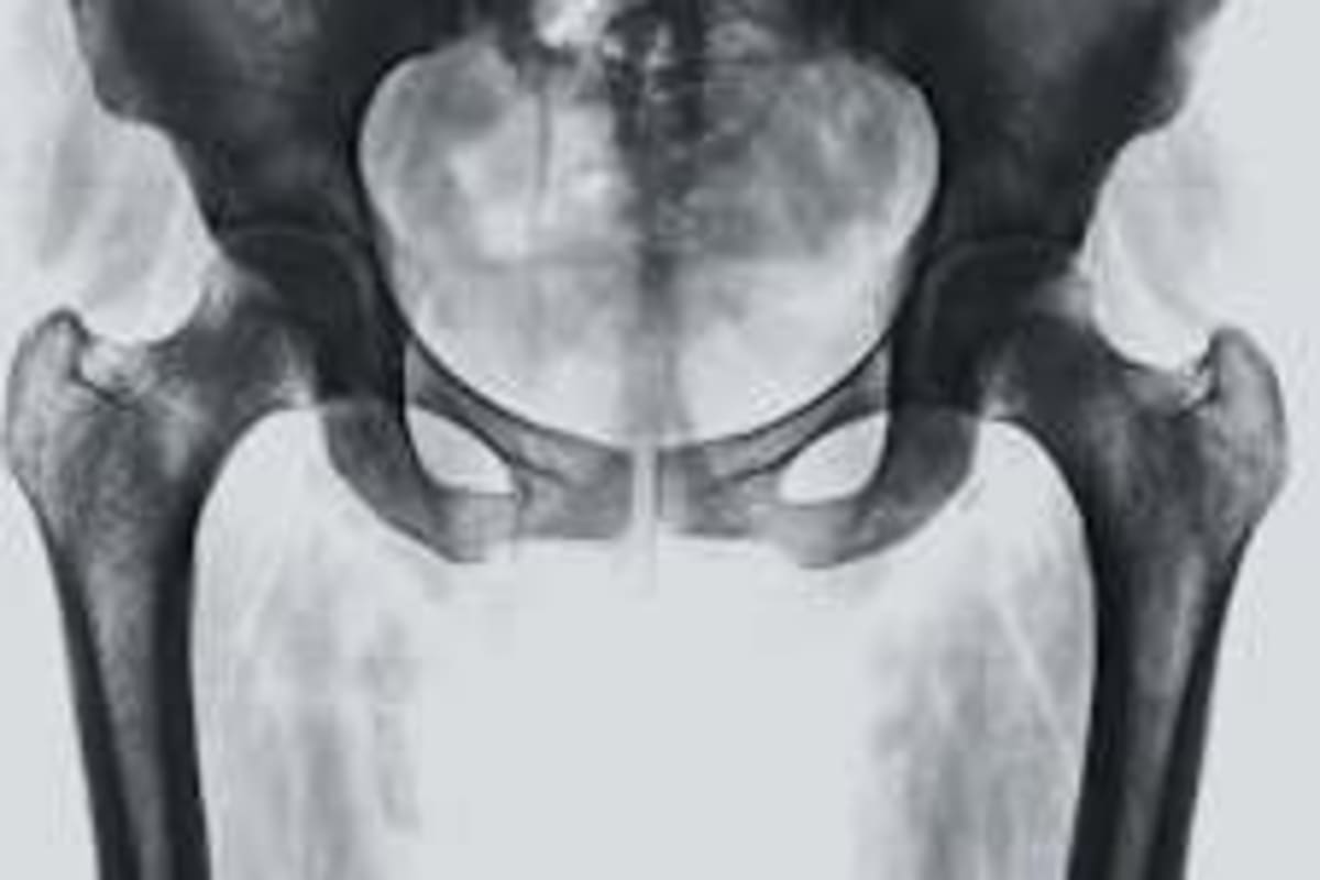 Yellow Payphones Connect Lonely Seniors and College Kids - Image 4