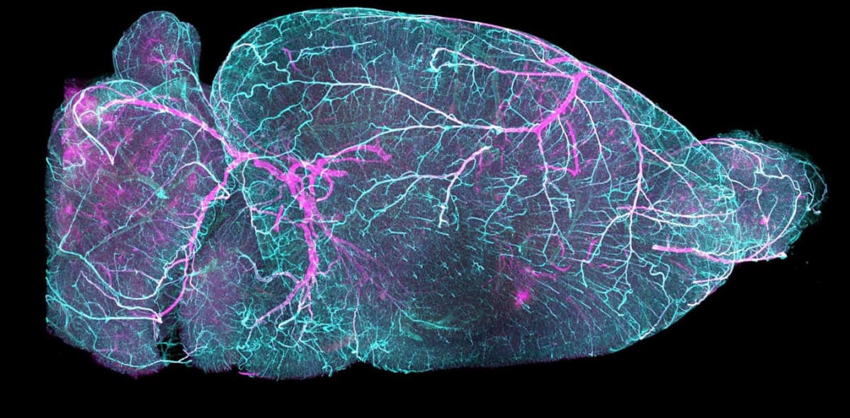 Illustration showing network of small blood vessels and capillaries in blue supplying the human brain