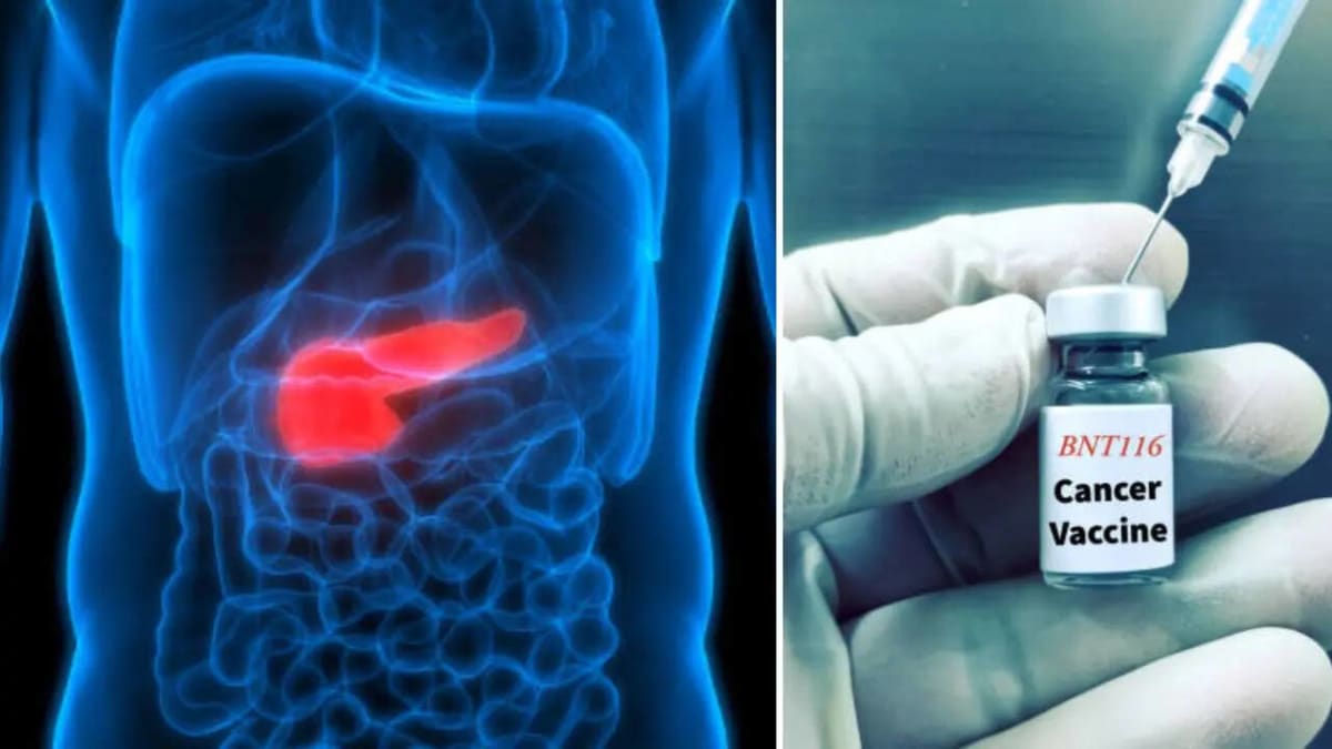 Pancreatic Cancer Vaccine: Patients Survive 6+ Years - Image 2