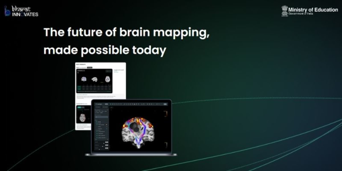 Bengaluru Startup Uses AI to Map the Brain in an Hour