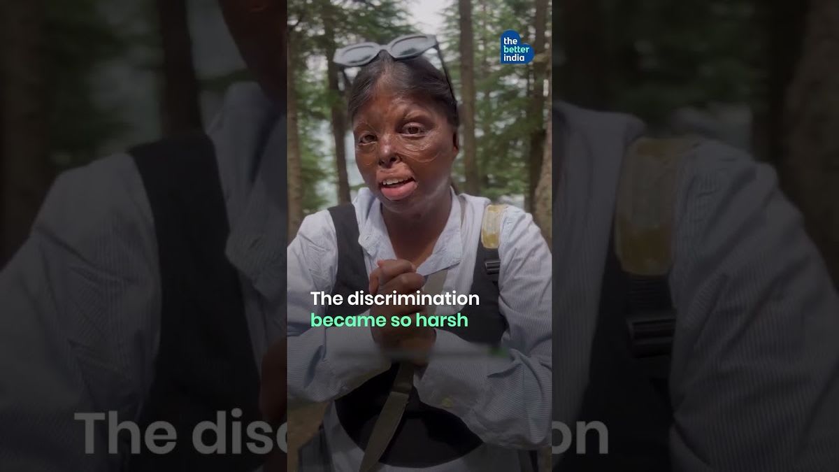 Manisha Prajapati creating makeup content, showing confidence and artistry beyond scars