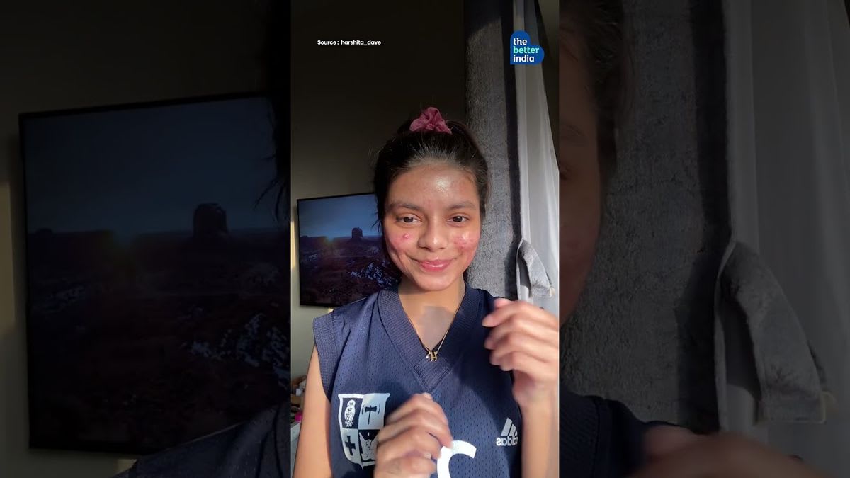 Woman Turns Acne Struggle Into Skin Positivity Movement