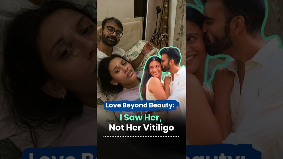 Woman With Vitiligo Built Confidence, Then Found True Love