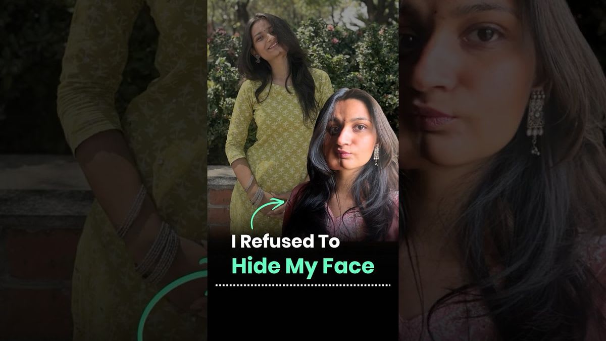 Woman With Rare Disorder Inspires Millions Online
