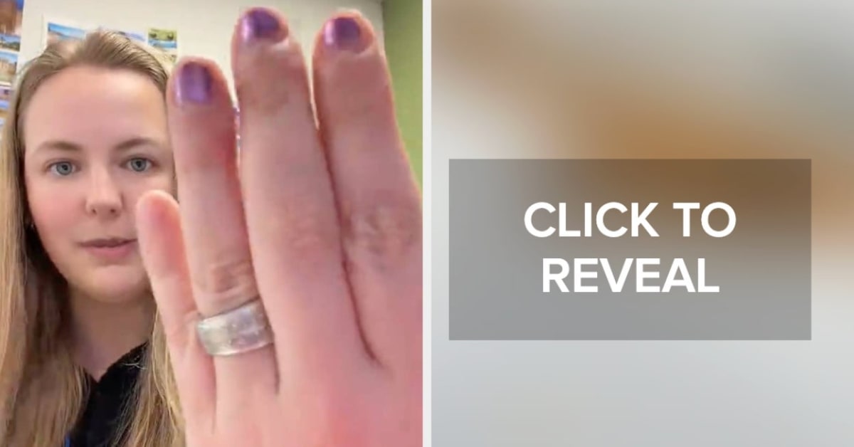 Teacher holding pen with middle finger grip showing calluses from writing style