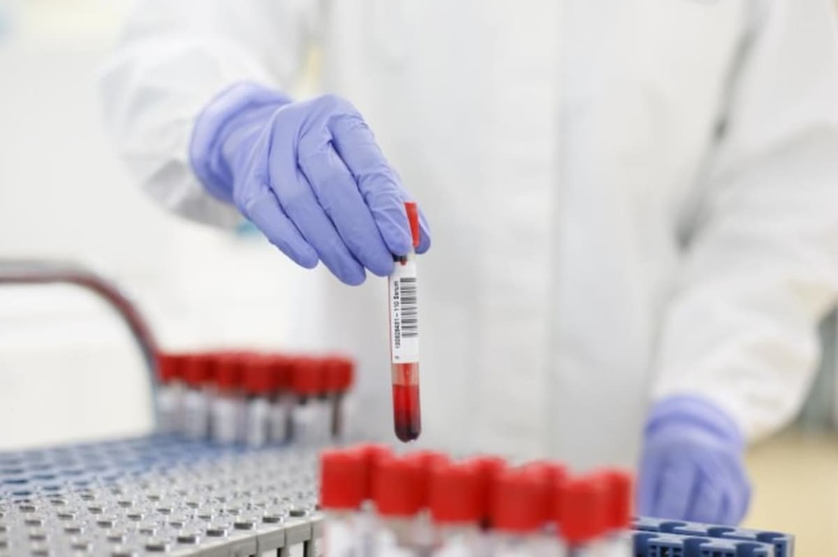 Blood Test Solves Cancer's Hardest Mystery in Days - Image 4