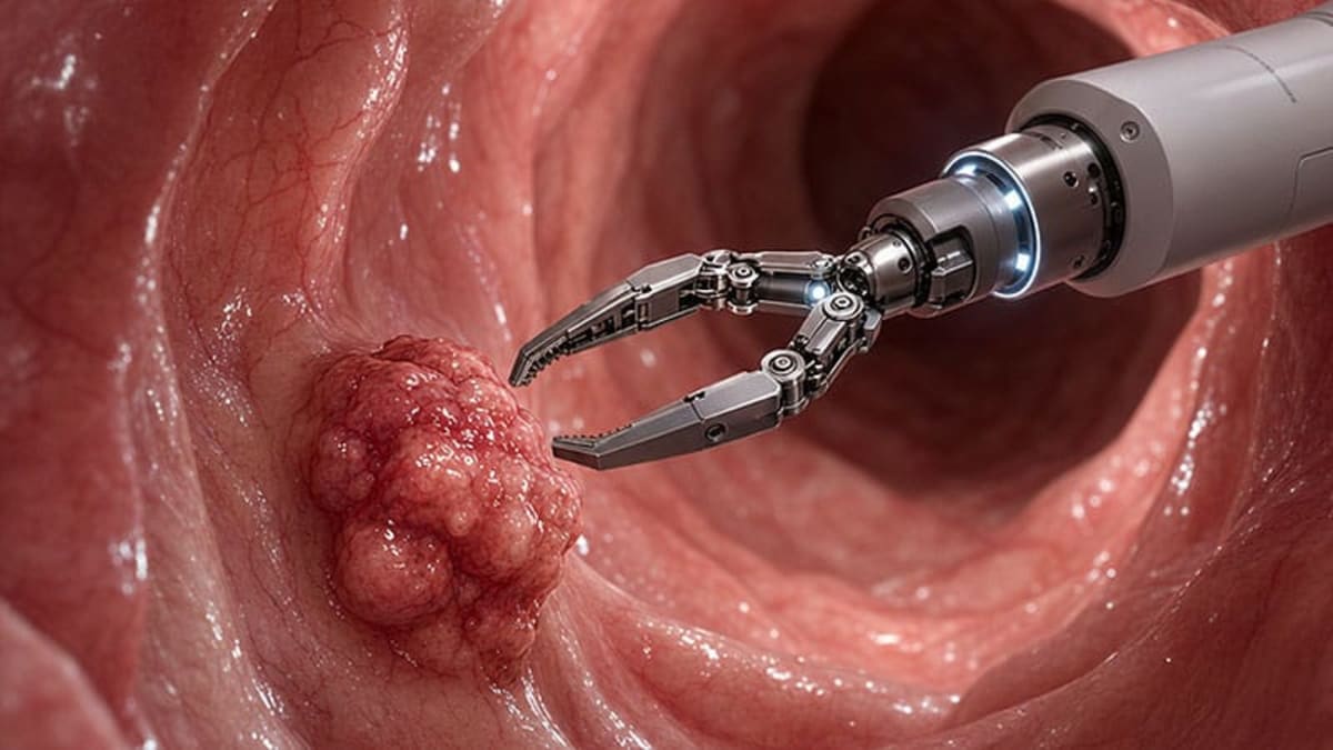 Microscopic metallic robots designed to collect tissue samples inside the human digestive system