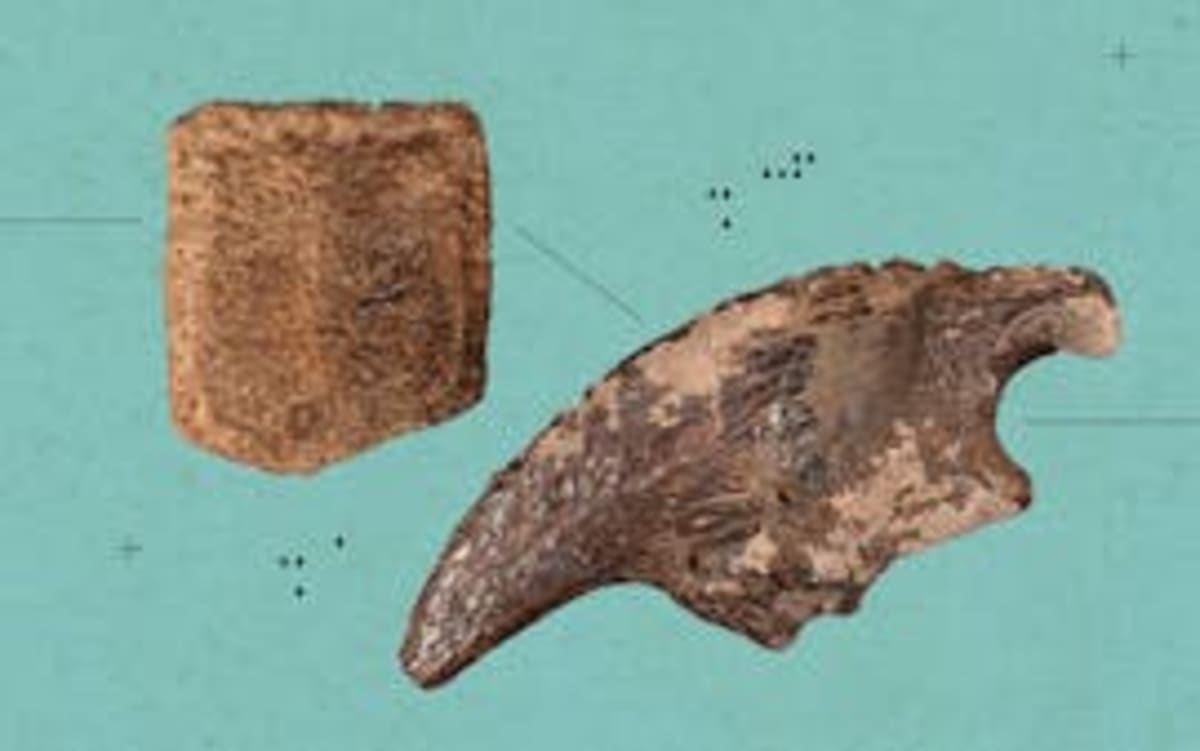 Texas Mom Funds Gene Therapy That Saved Her Son - Image 5