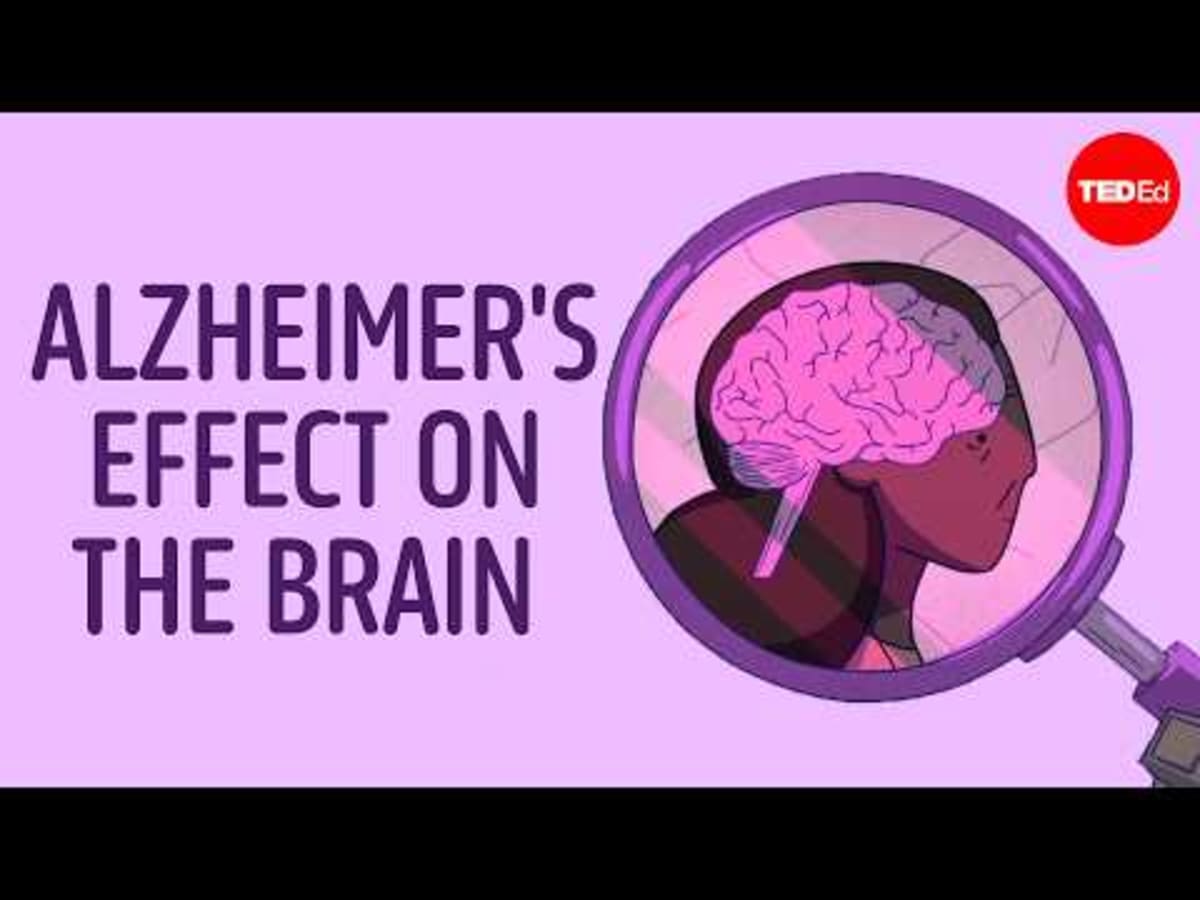 Simple Nerve Treatment May Protect Memory From Alzheimer's - Image 4