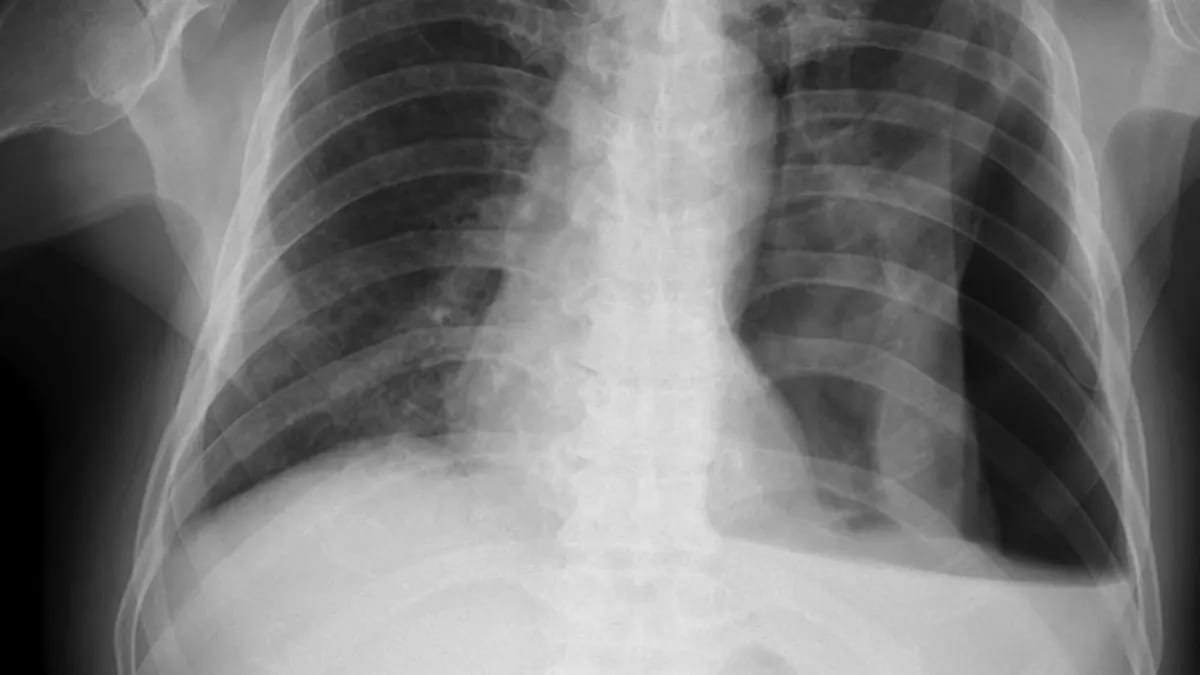 AI Reads X-Rays in Minutes, Helps Doctors Save Time - Image 3