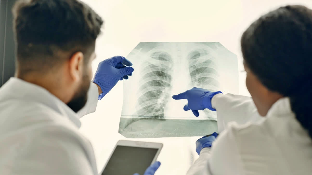 Medical illustration showing healthy lung tissue compared to scarred fibrotic lung tissue