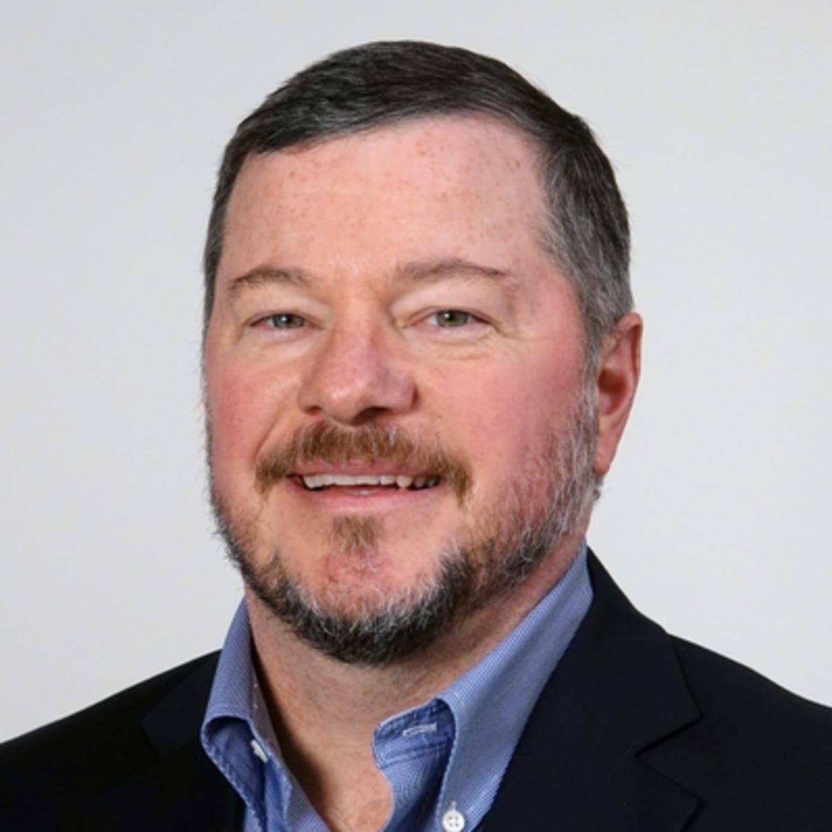 Rochester Scientists Target Early Vision Loss in AMD - Image 3