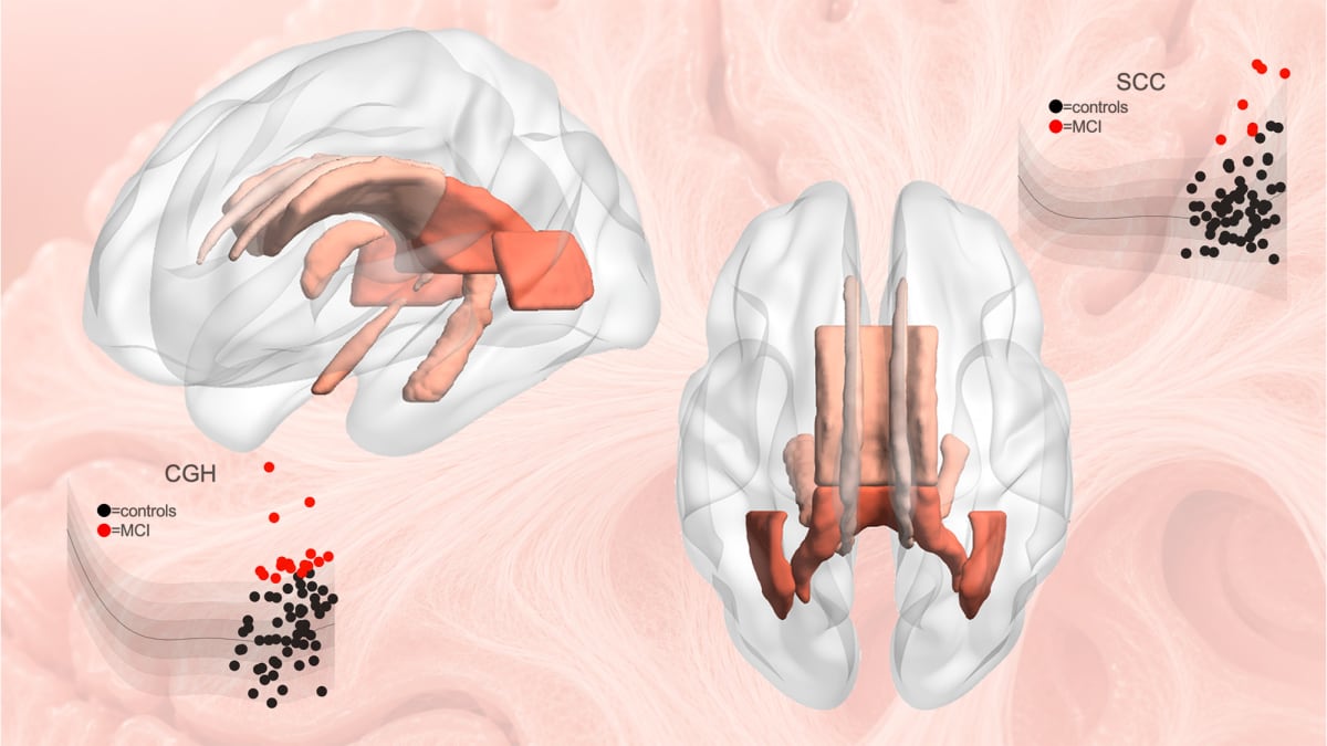 Statistical brain charts compiled from thousands of brain scans showing neural pathway development across lifespan