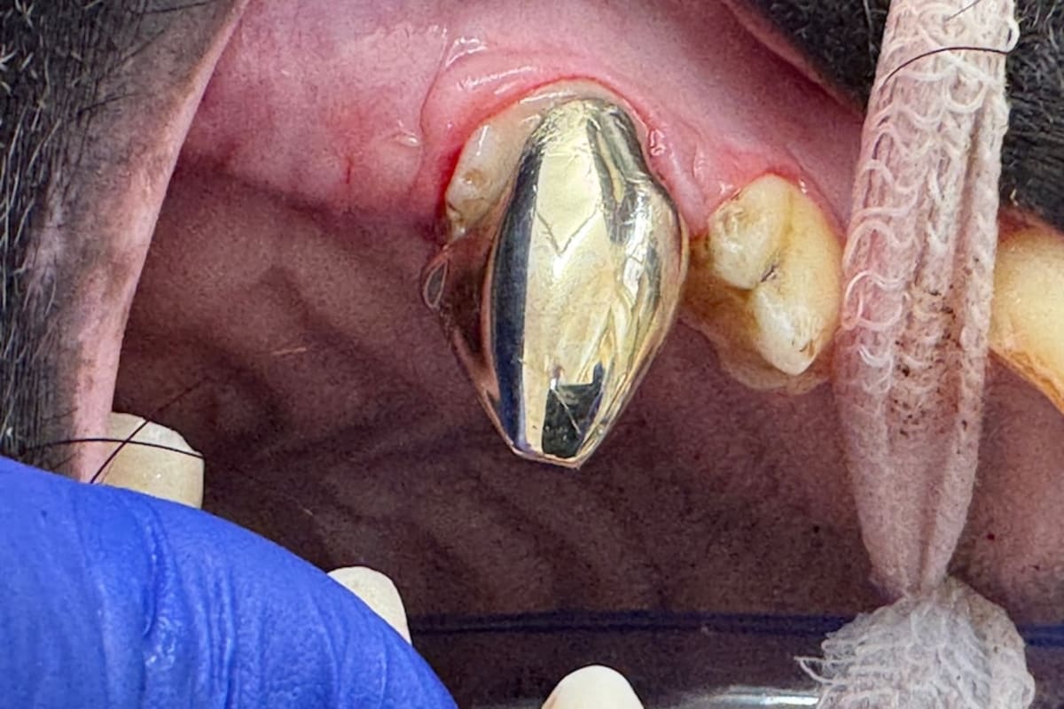 Hyena Gets Gold Crown to Fix Teeth After Cub Injury - Image 3