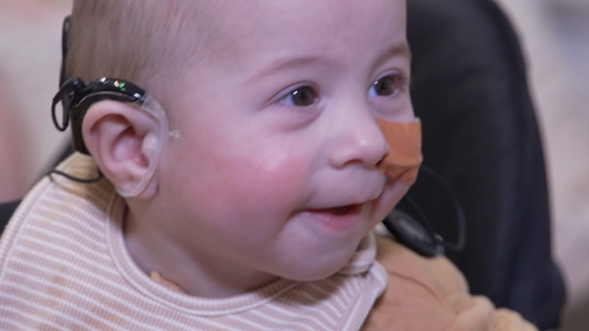 Deaf Twin Babies Hear Mum's Voice in Australian First - Image 2