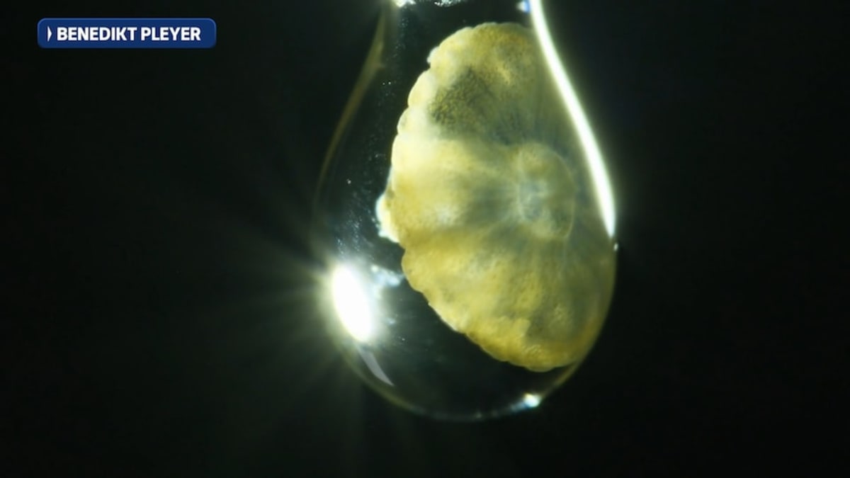 Microscopic Video Contest Reveals Hidden World of Tiny Life - Image 4