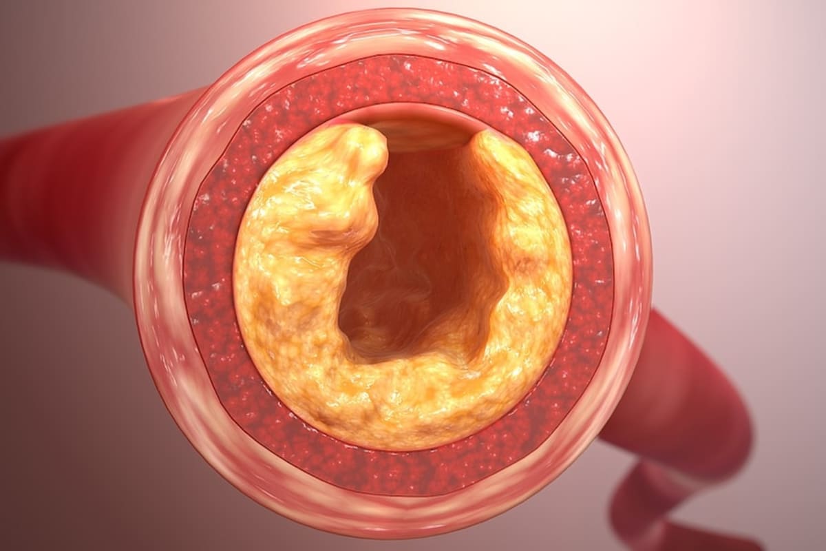 Heart Surgery Safer, Faster Than Ever Before in Australia - Image 5