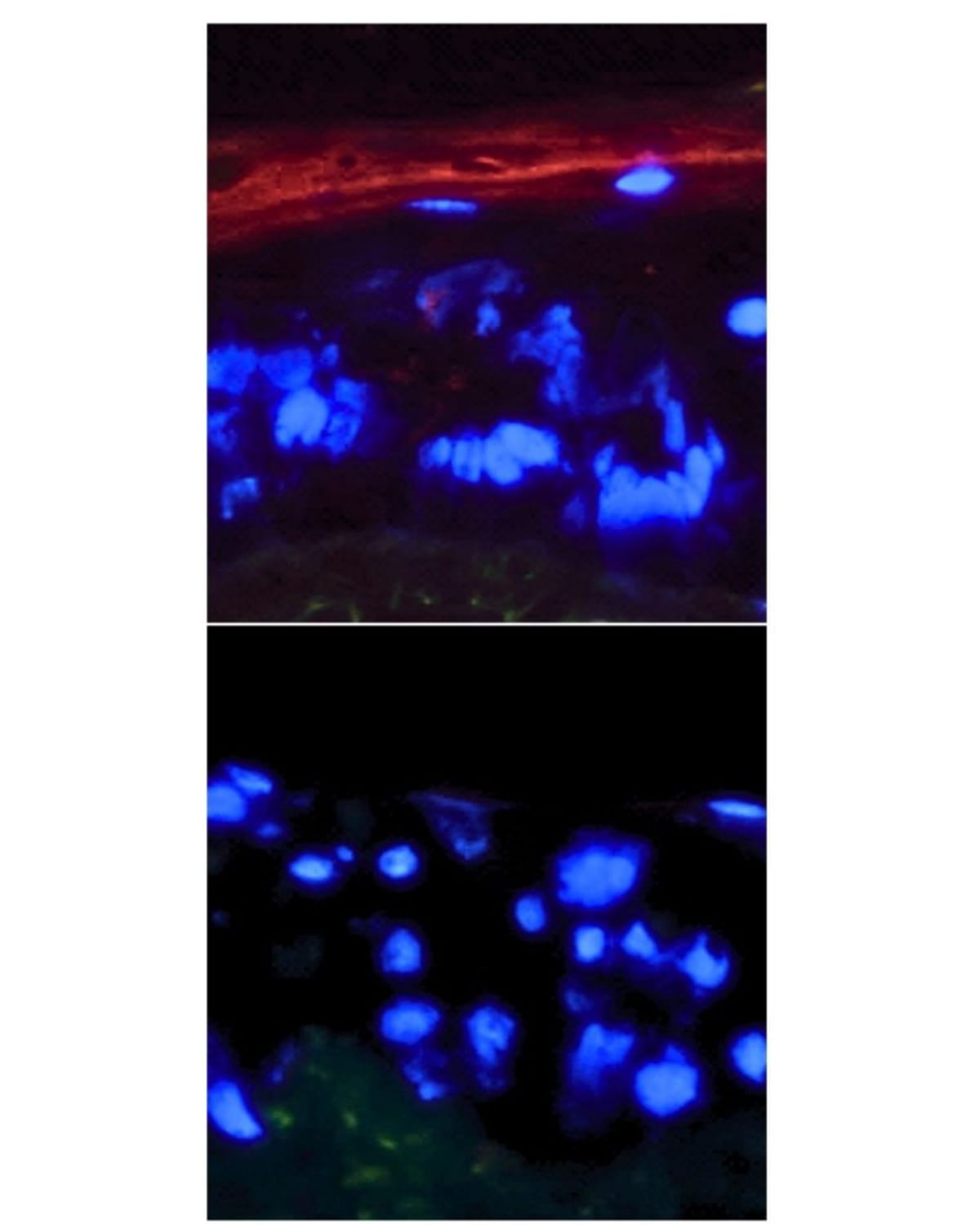 Stanford Finds Skin's Master Switch for Healing & Cancer - Image 2