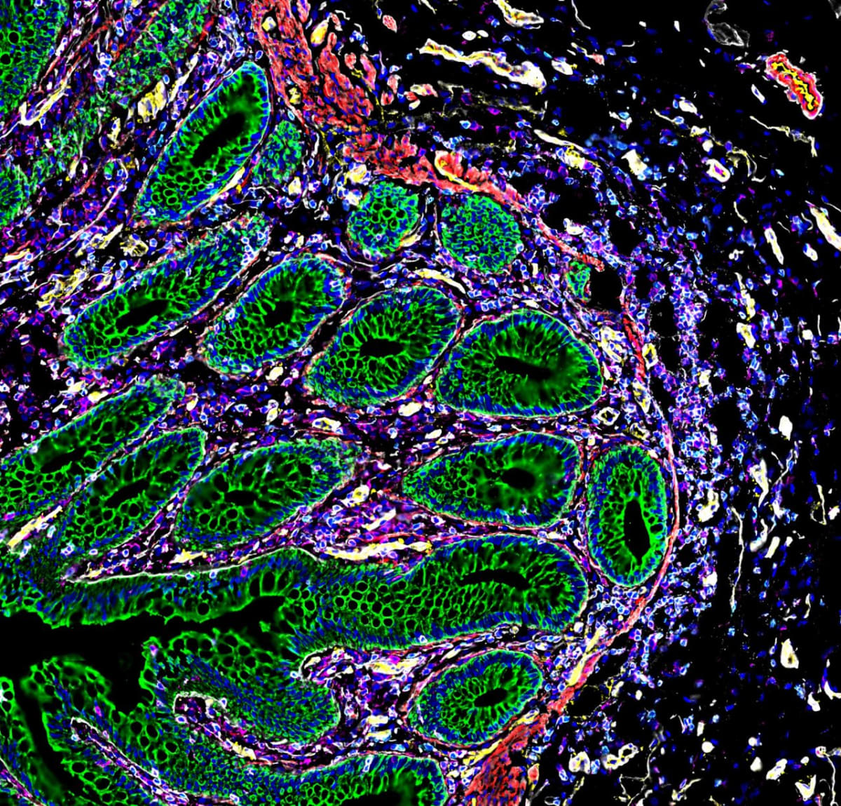 Stanford Maps Human Biology Across Ethnicities Worldwide - Image 5
